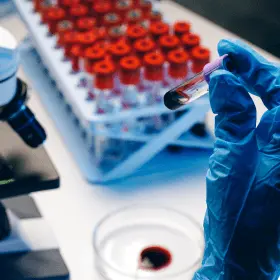 Haematology